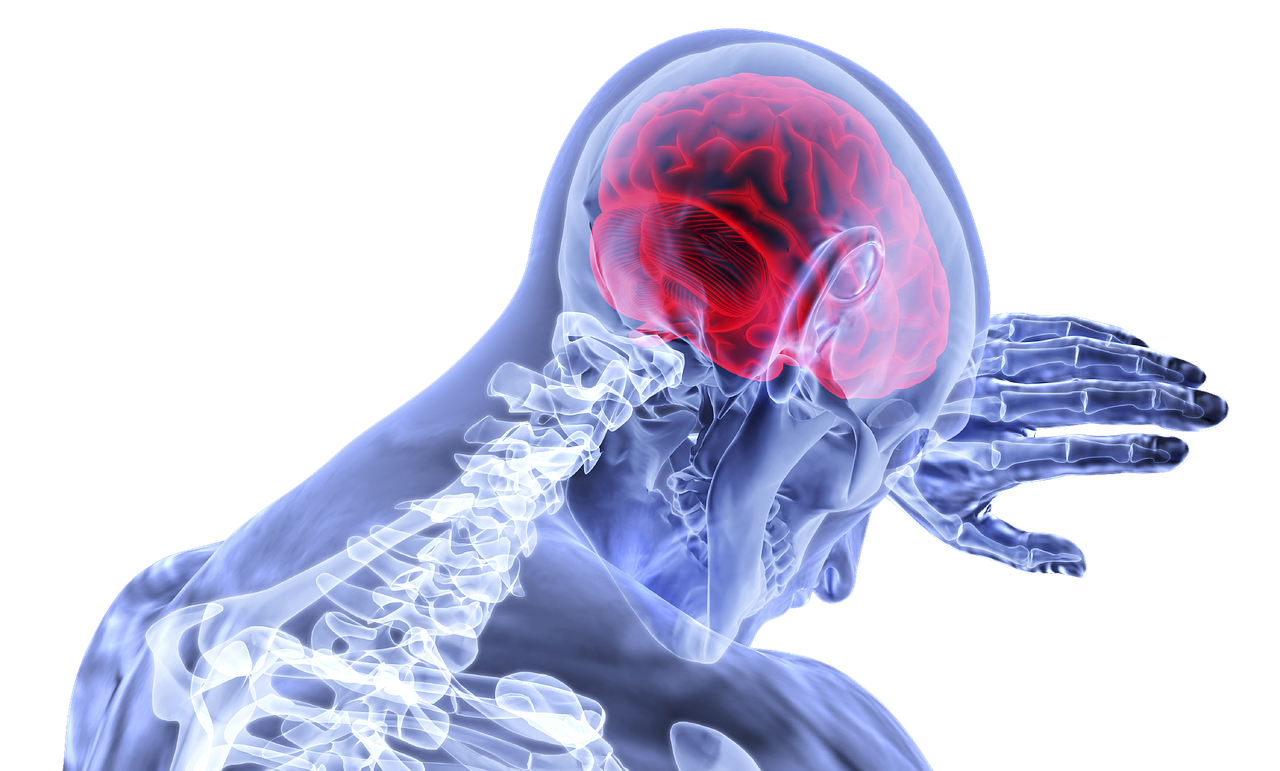 Image shows a skeleton with the brain highlighted in red symbolising a stroke